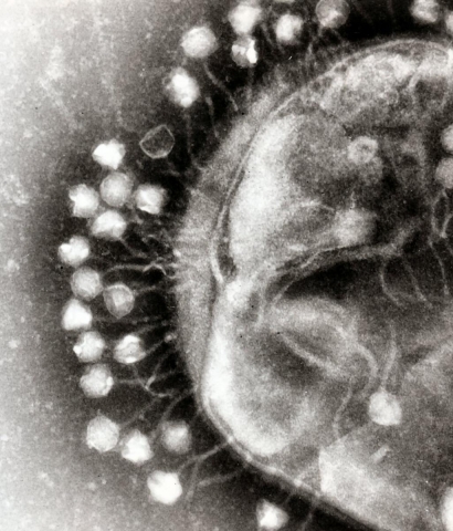 噬菌体病毒