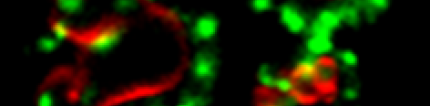 细胞生长和疾病中的内体蛋白转运:酵母作为神经退行性疾病的模型