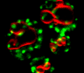 细胞生长和疾病中的内体蛋白转运:酵母作为神经退行性疾病的模型